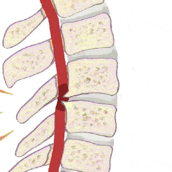 这种病开始“进攻”小学生！看完这条新闻，请抬头10秒
