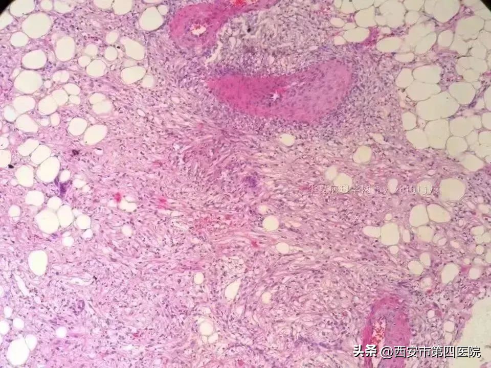 鍏ㄦ皯鍋ュ悍绱犲吇鎻愬崌璁″垝,鍏ㄦ皯鍋ュ悍姘村钩鎻愬崌琛屽姩璧勬枡