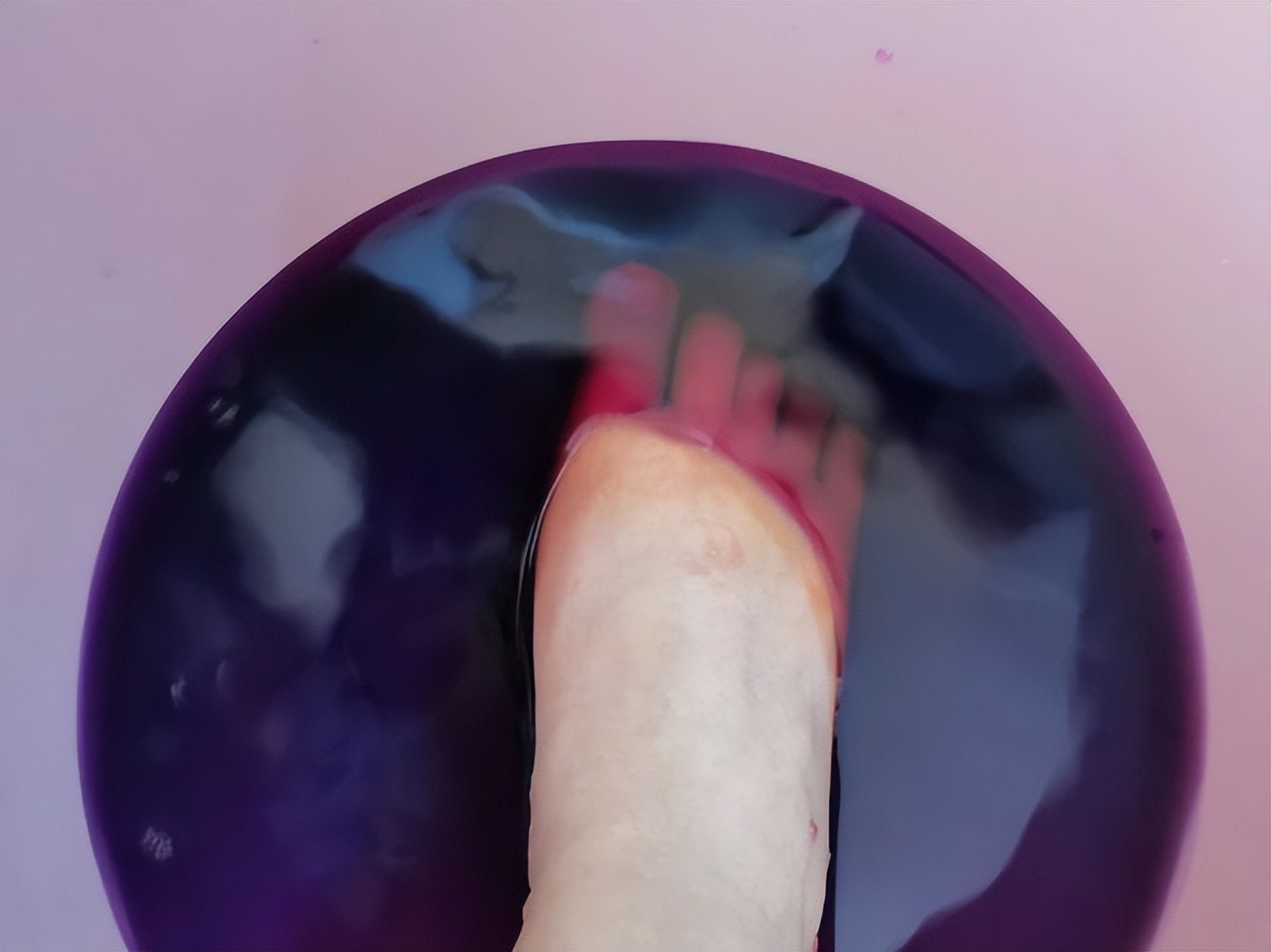 学会这3个小方法，在家轻松摆脱灰指甲！