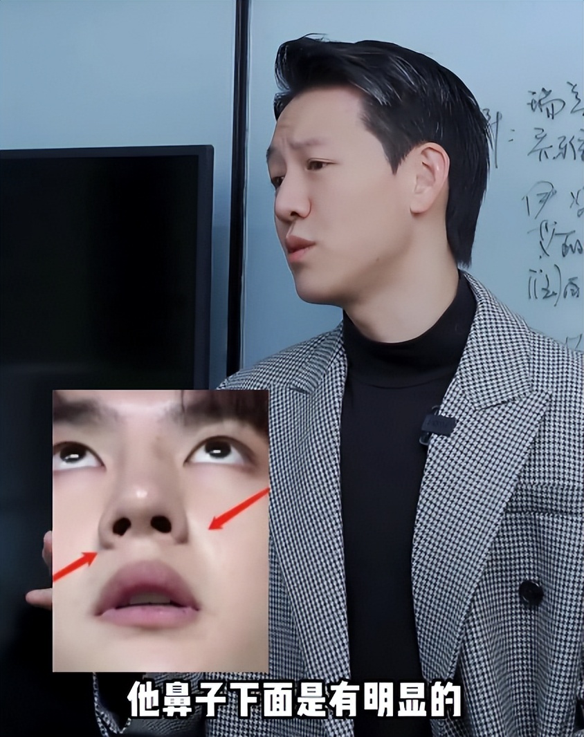 王一博脸型无颧骨,王一博的法令纹