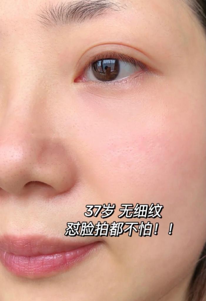 脸部皱纹分很多种，第一显老的是它？来看看如何“对症下药”