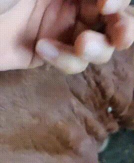 夏季常见蚊虫叮咬图鉴,女孩被家人吸血10年