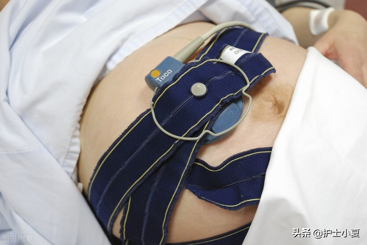 胎儿心律失常怎么办,胎儿心律失常呈三联律