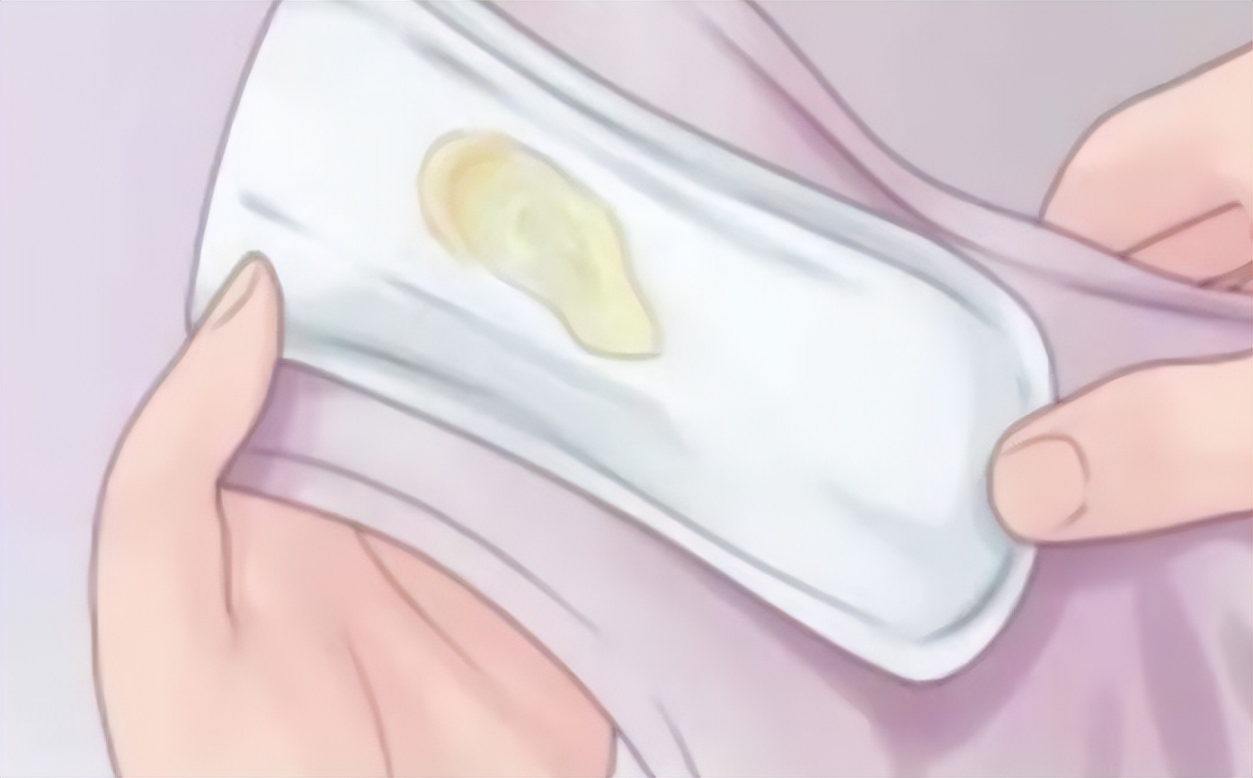 女人出现豆腐渣白带，可能提示身体出了问题