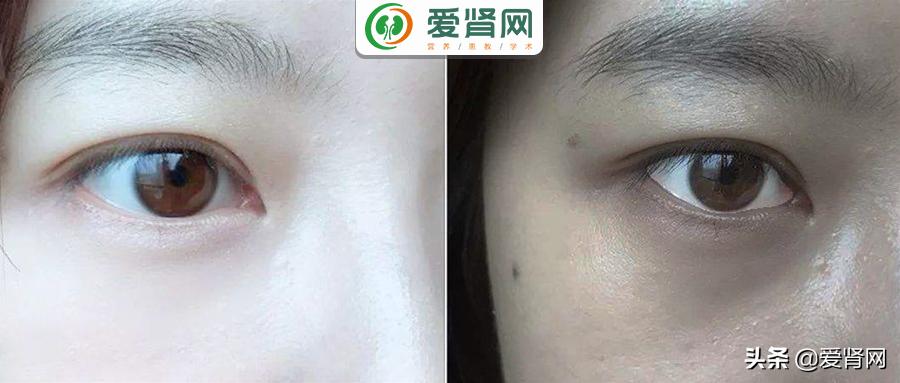 皮肤越变越黑,皮肤黑的暗淡无光怎么办