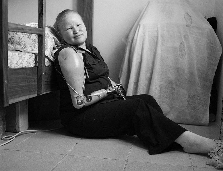 非洲版唐僧：血液堪比钻石，躯干价值126万元，警方24小时守卫