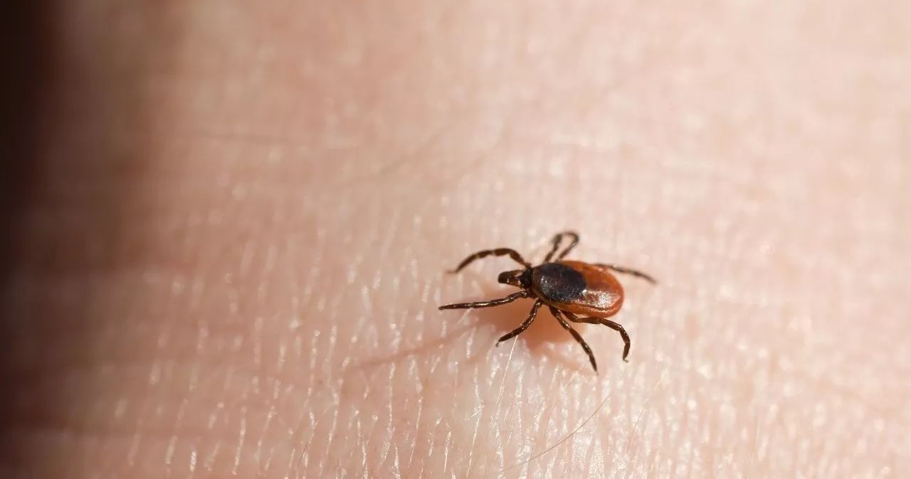 虫咬性皮炎的防治方法有哪些,去除顽固性虫咬皮炎的简单方法