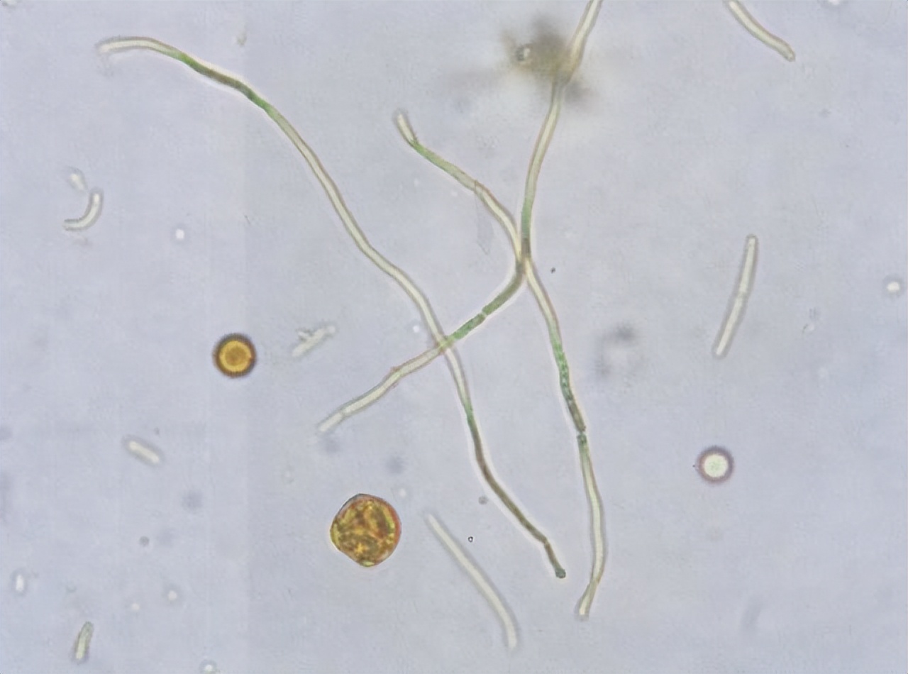 金黄色葡萄球菌的微生物特性,金黄色葡萄球菌的培养特性