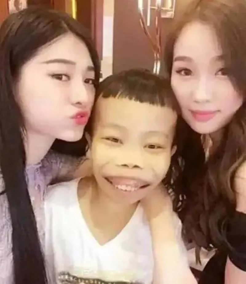 农村娃陈山,最丑网红陈山现状