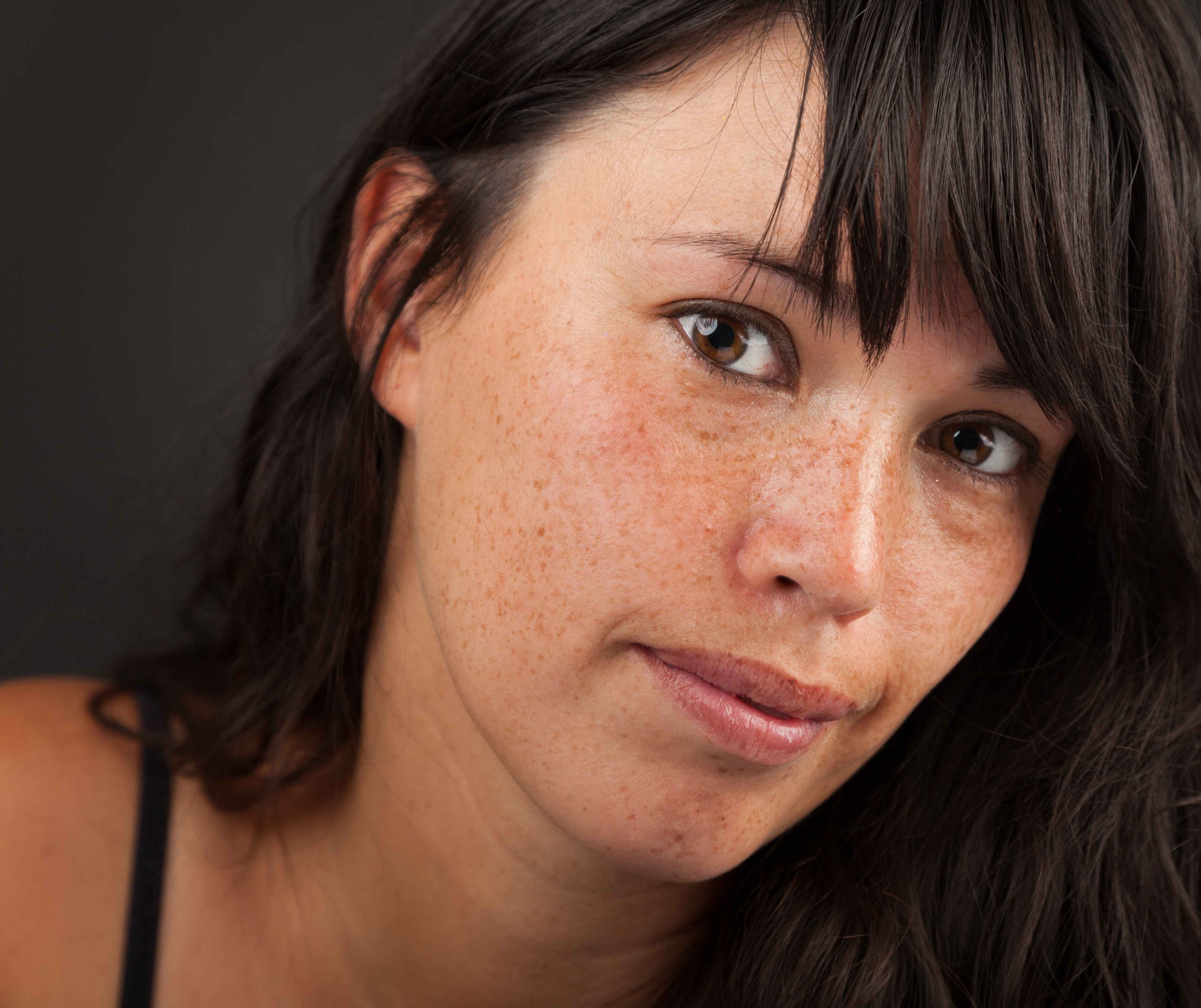 长斑的皮肤很暗沉怎么办,40岁皮肤暗黄有斑是什么原因