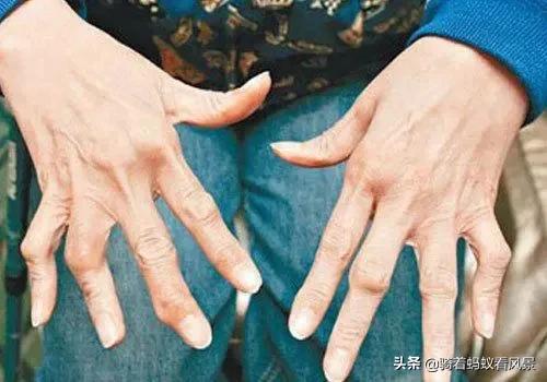 如何有效避免回南天,回南天小常识