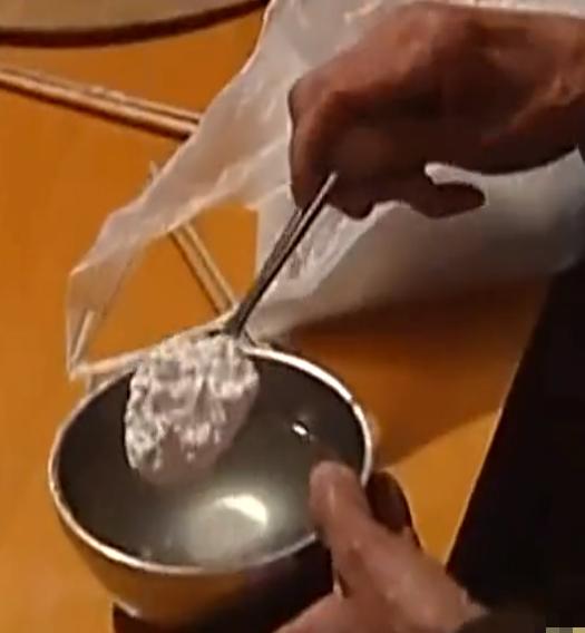 重庆一妇女肚子巨大,女子肚大如球竟是5颗肿瘤