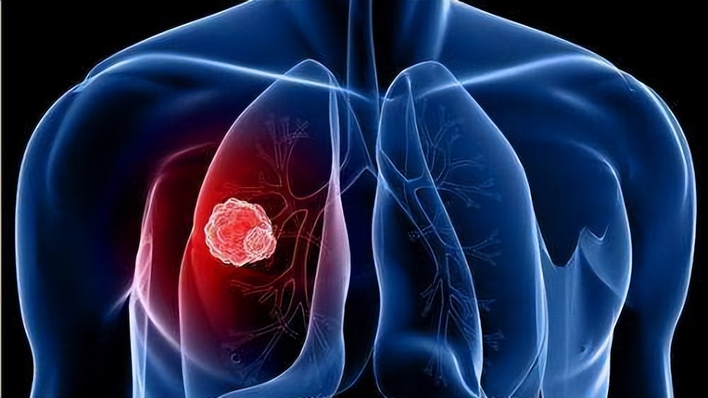 肩膀疼痛要警惕的三种病肩周炎,肩周炎是什么原因造成的肩膀痛