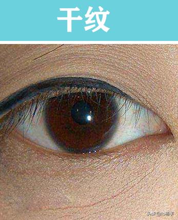 干纹细纹最佳治疗方法,干纹皱纹怎么去除小方法