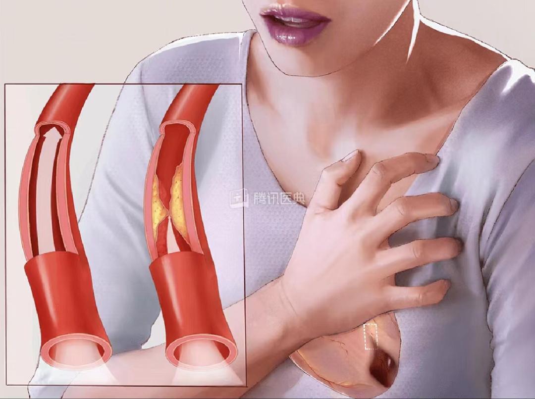 被气出来的6种疾病每一种都要命,这些病都是被气出来的看看这4点