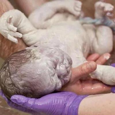 26岁女子剖腹产生下“白雪公主”，浑身苍白，老公决定放弃治疗