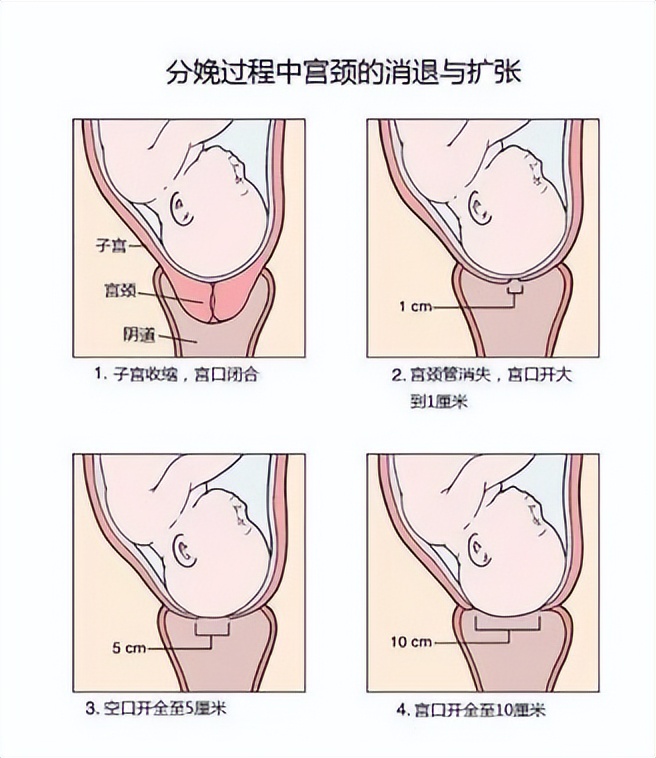 产后会阴裂伤真的像芒果吗,产后裂伤愈合后还会有裂纹嘛