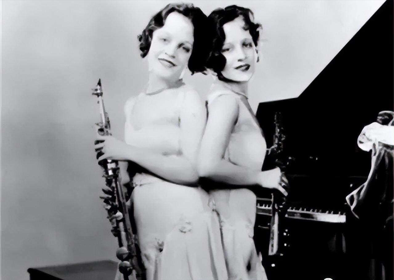 英国连体姐妹分离手术大结局,英国连体姐妹姐姐死后怎样