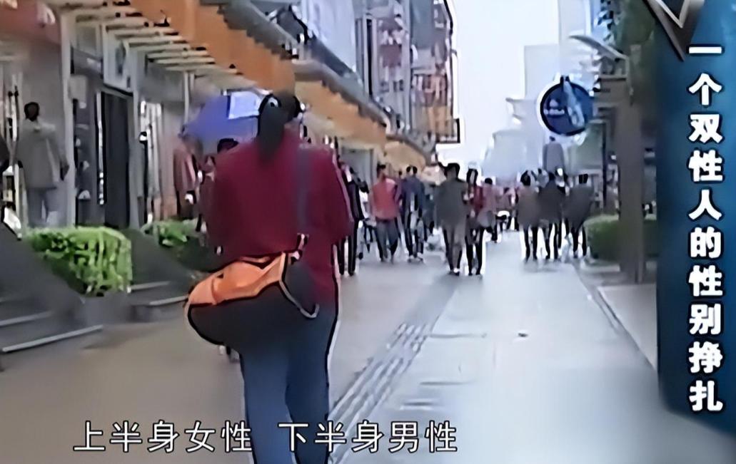 湖南出现双性人,罕见双性人现状