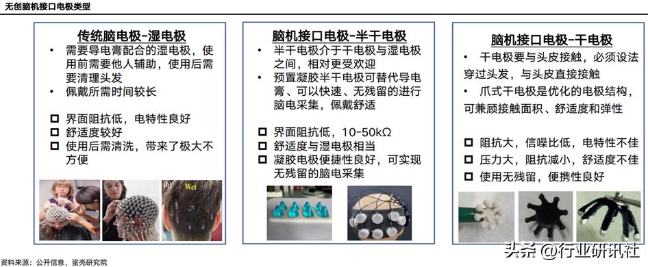 脑机接口发展现状及展望,脑机接口公司靠什么盈利