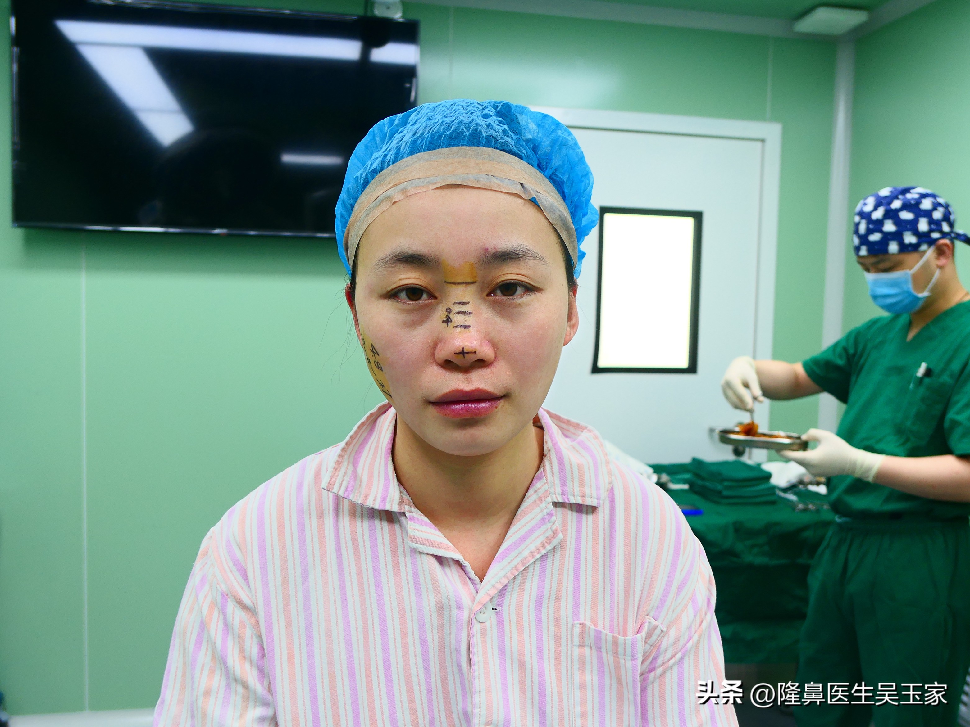 天津28岁姑娘动手术,29岁女子瞒着家人整容