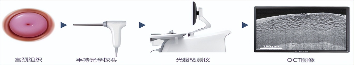 「母亲节」HPV病毒感染一定会导致宫颈癌吗？|健康医专栏第四期