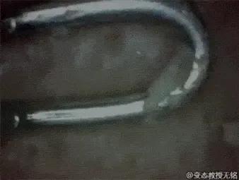 鼻翼油脂粒怎么去除,鼻翼两侧出油多怎么清洁