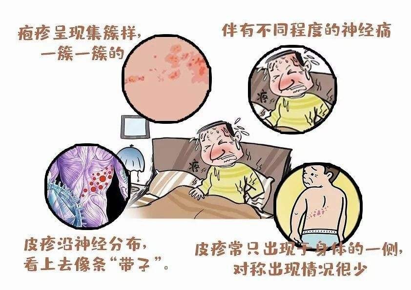 得了带状疱疹的是终身的吗,得了带状疱疹的患者会自愈吗