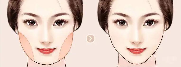 韦敏吸脂,九院整形科医生韦敏