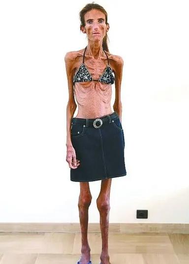 身高一米七140斤怎么减肥,身高一米七体重74公斤怎么减肥