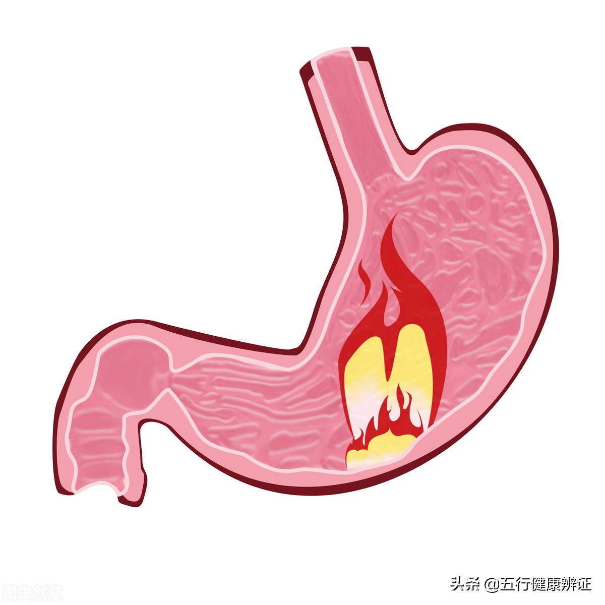 反酸口苦到底是胃不好还是肝不好,萎缩胃炎口苦是肝胃不和吗
