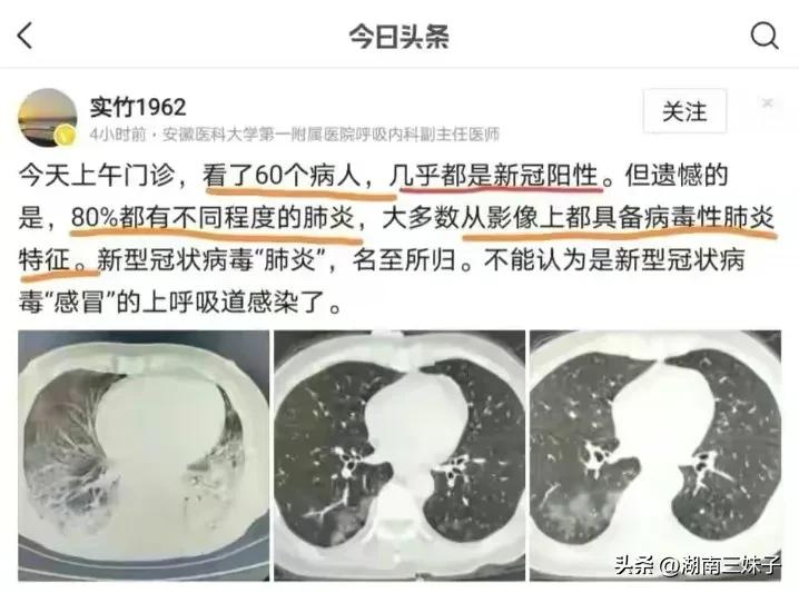 普通严重感冒会成白肺吗,流行感冒白肺