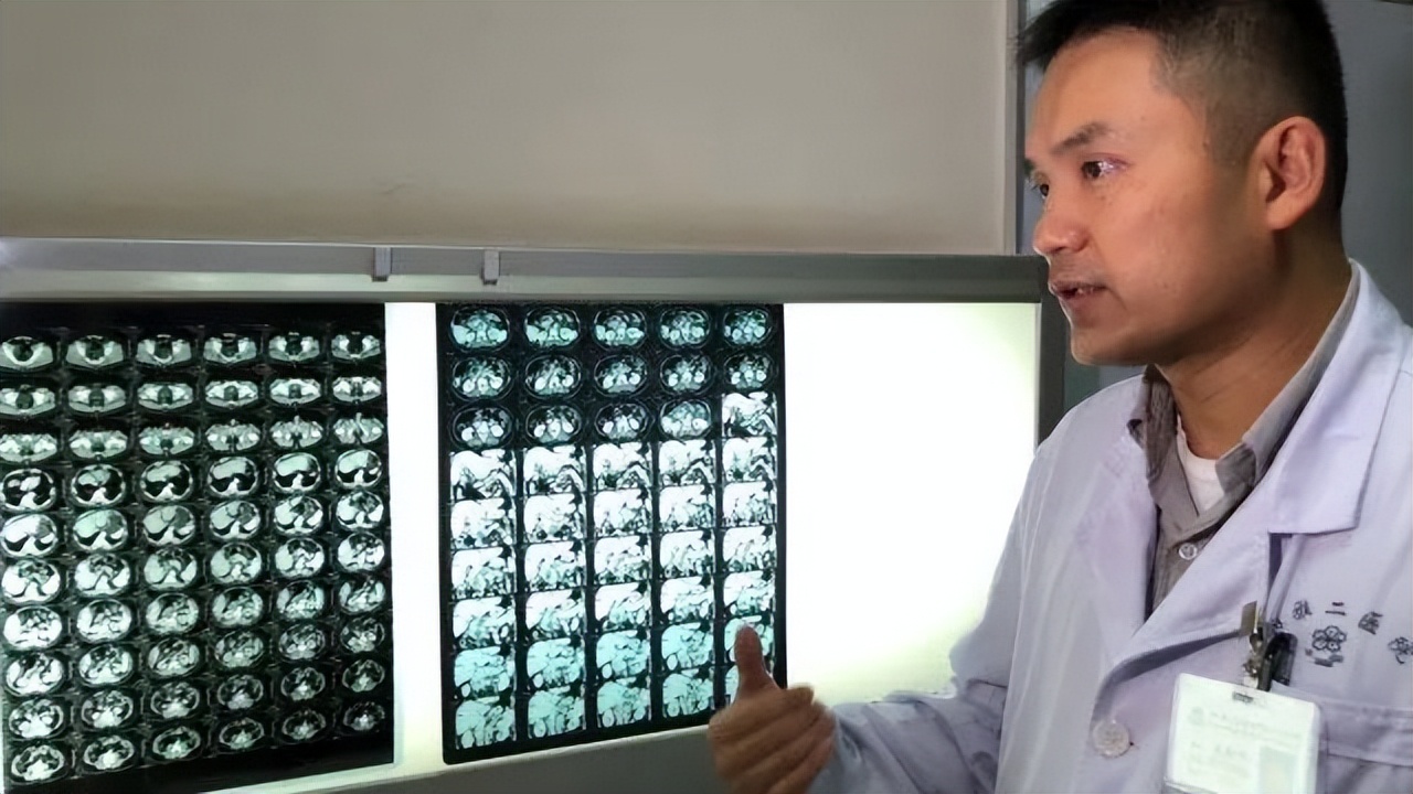 医生刘翔峰切病人器官是真的吗,医生手术随意切除病人器官