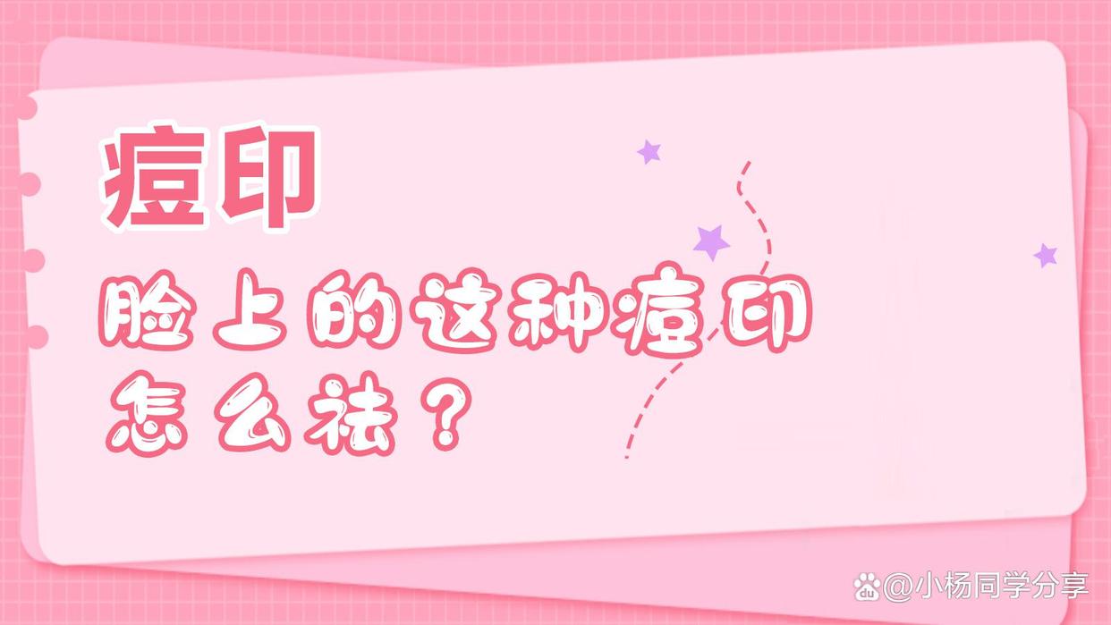 临河祛脸上的痘印,什么药膏祛脸上痘印比较好