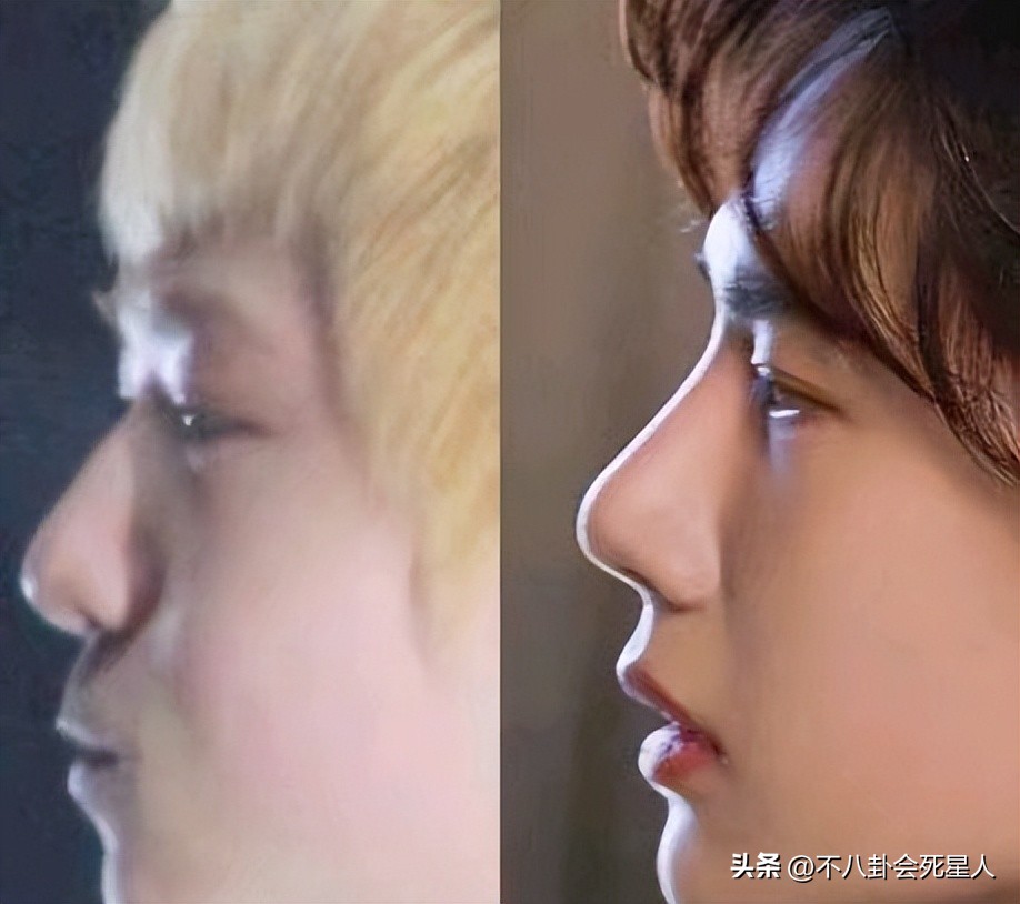 演员假发套穿帮,假发穿帮镜头