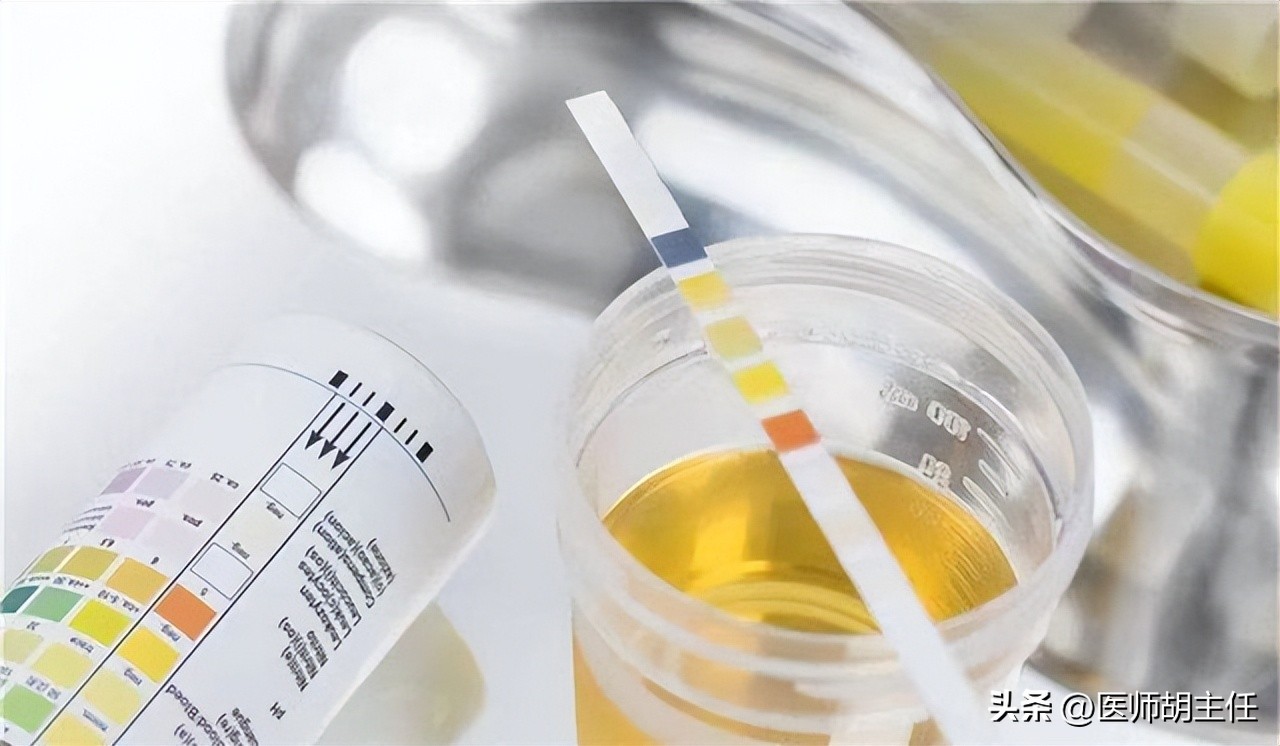 非布司他对痛风的治疗效果,治疗痛风的非布司他服用方法