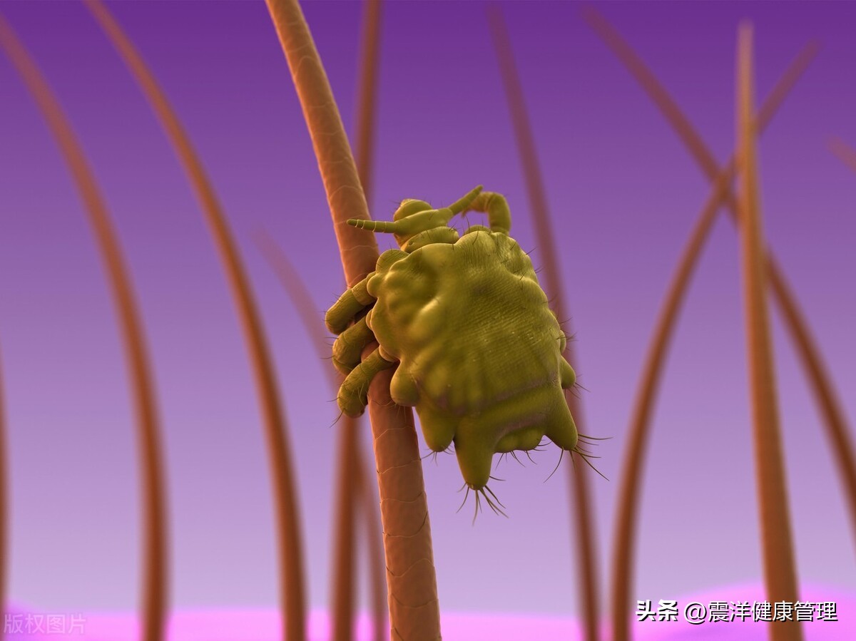 男子腹部痒，医生用镊子夹出16只阴虱！原来阴虱的传播途径有4个