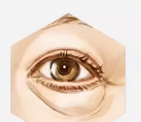 眼袋大怎么办如何解决快又好,眼袋大很显老小妙招