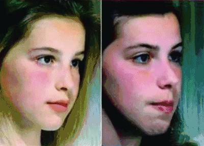 口呼吸|听说变丑是因为习惯用嘴呼吸？