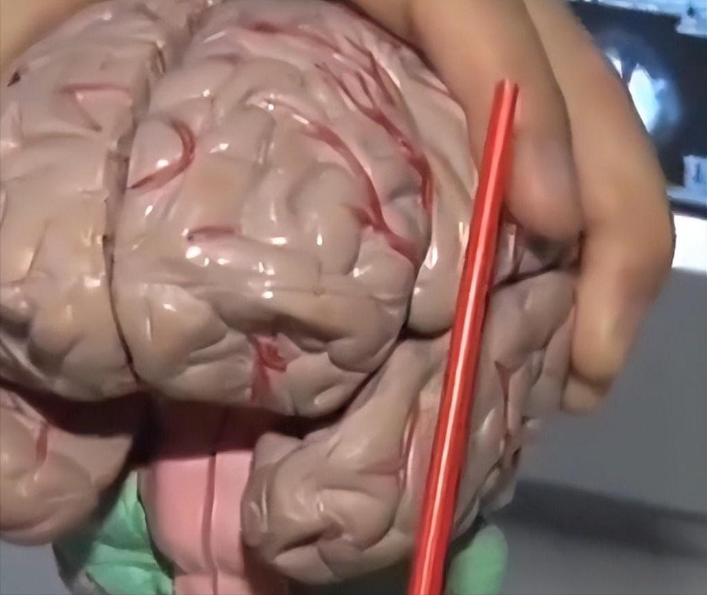 11岁男孩突然高烧呕吐,14岁孩子突发脑炎呕吐