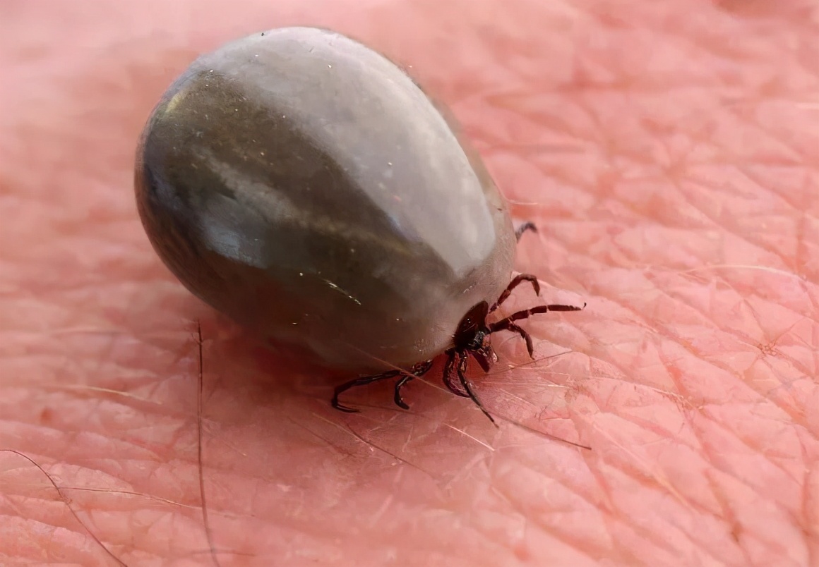 被蜱虫咬后死亡的几率有多大,夺命蜱虫怎么去除