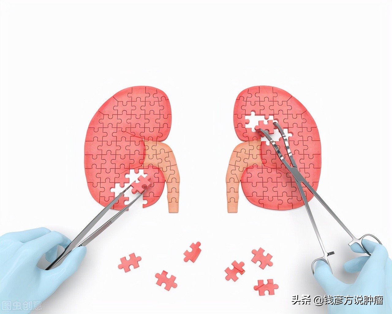 有很多中医治疗肾病真的能治好吗,中草药治肾病有哪些