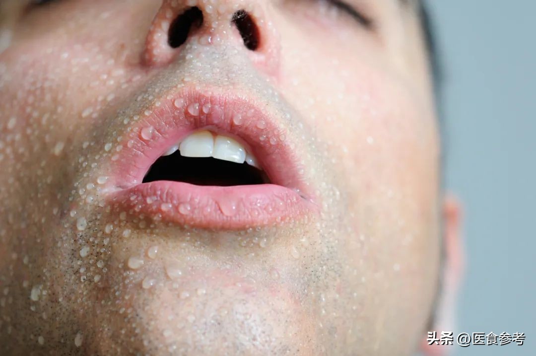 出汗有异常现象是中风前兆吗,哪几种异常出汗是中风前兆