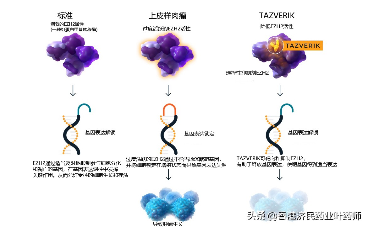 malt惰性淋巴瘤的靶向治疗,上皮样肉瘤靶向药价格