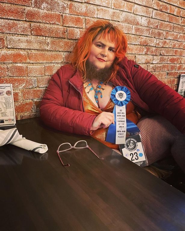 13岁的小女孩长胡子正常吗,13岁女孩长很多胡子