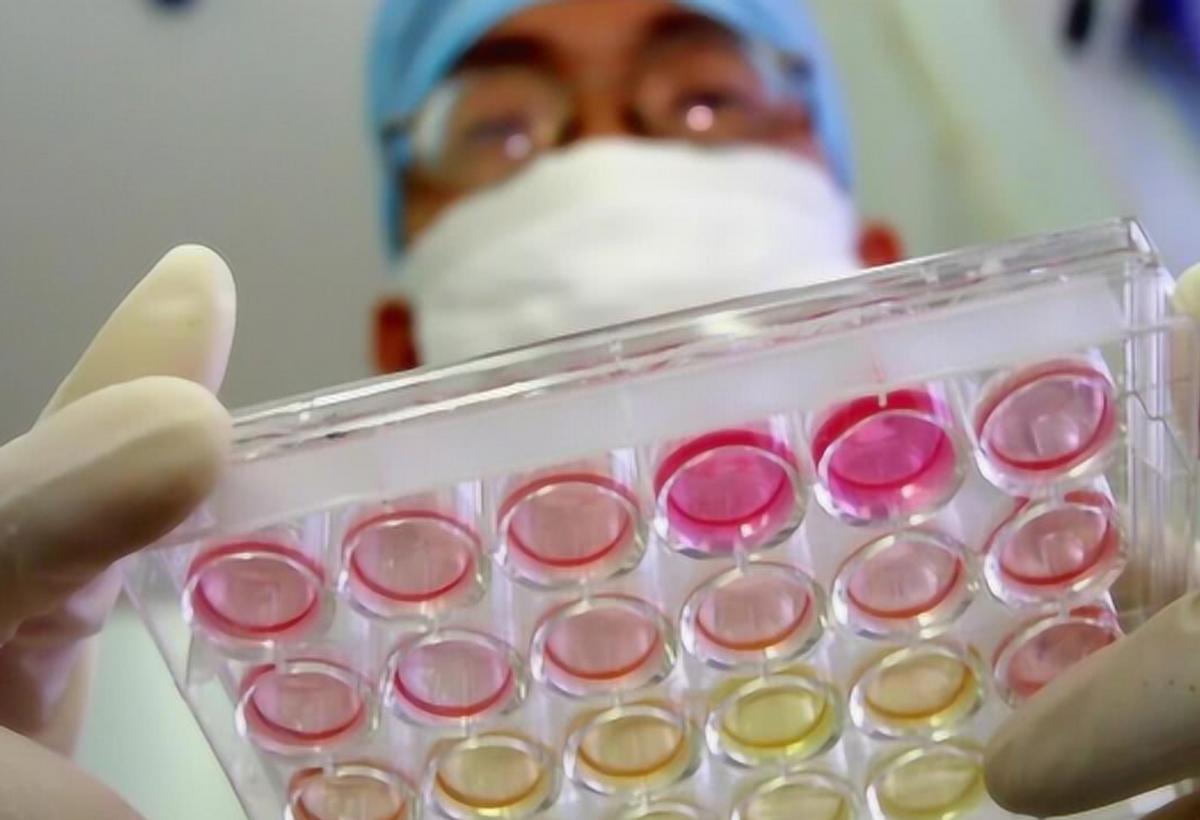 艾滋病后悔药价格,艾滋病后悔