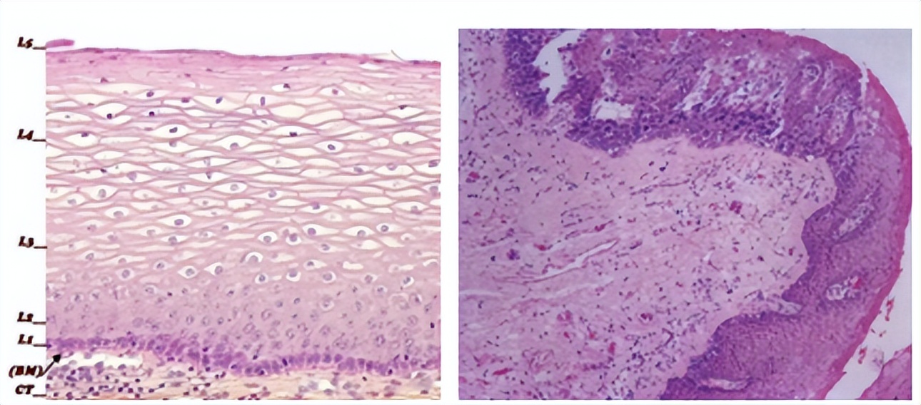 派特生物能治宫颈湿疣吗,派特灵妇科