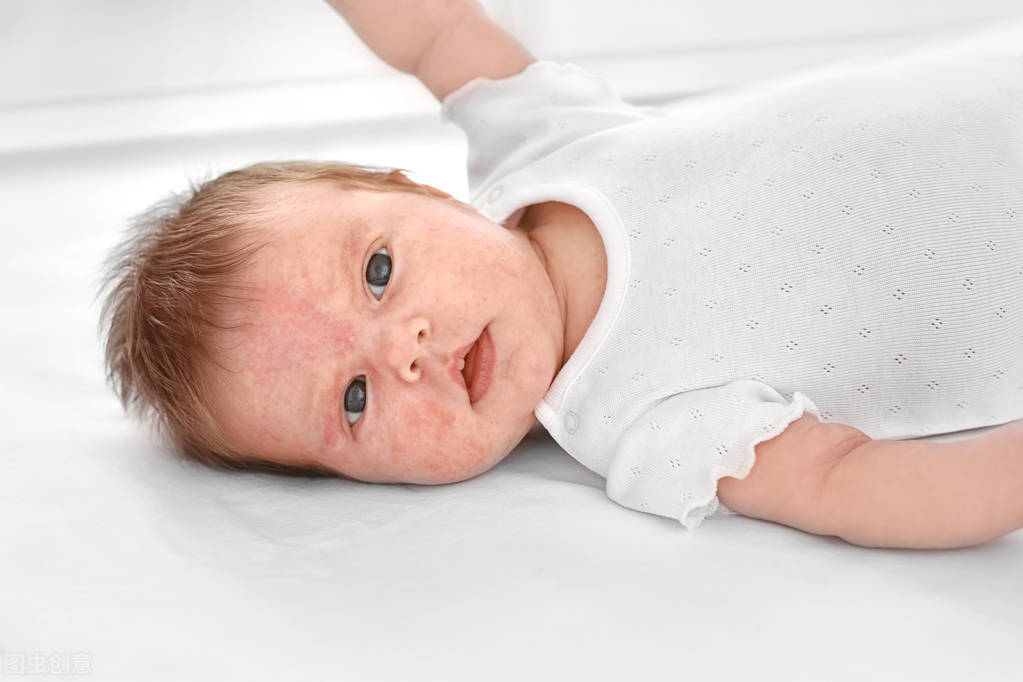 宝宝乳糖不耐受看宝妈一招搞定,宝宝乳糖不耐受腹泻影响发育吗