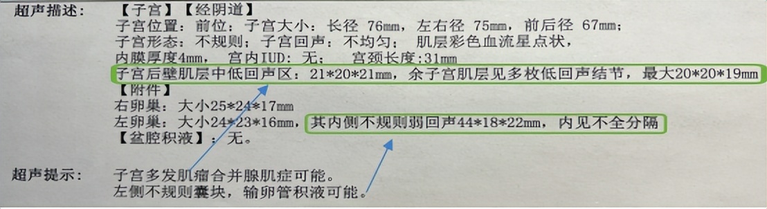 妇科检查可见少量dna倍体异常细胞,妇科检查b超的专业术语
