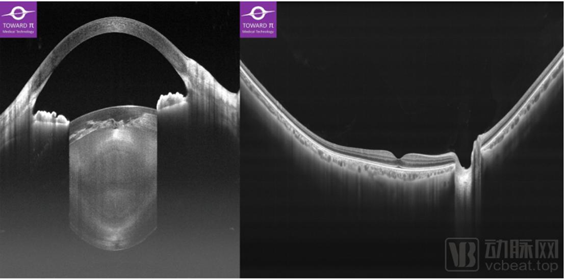 图湃医疗官网,图湃医疗